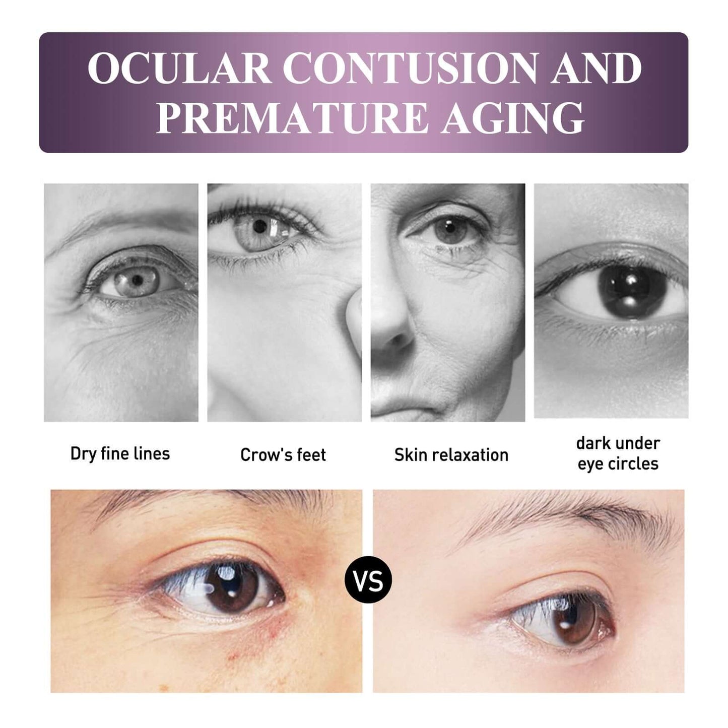 Popular Electric Anti-Wrinkle Eye Cream - Strengthen & Moisturize Under Eye Skin + Reduce Dark Circles ❣️