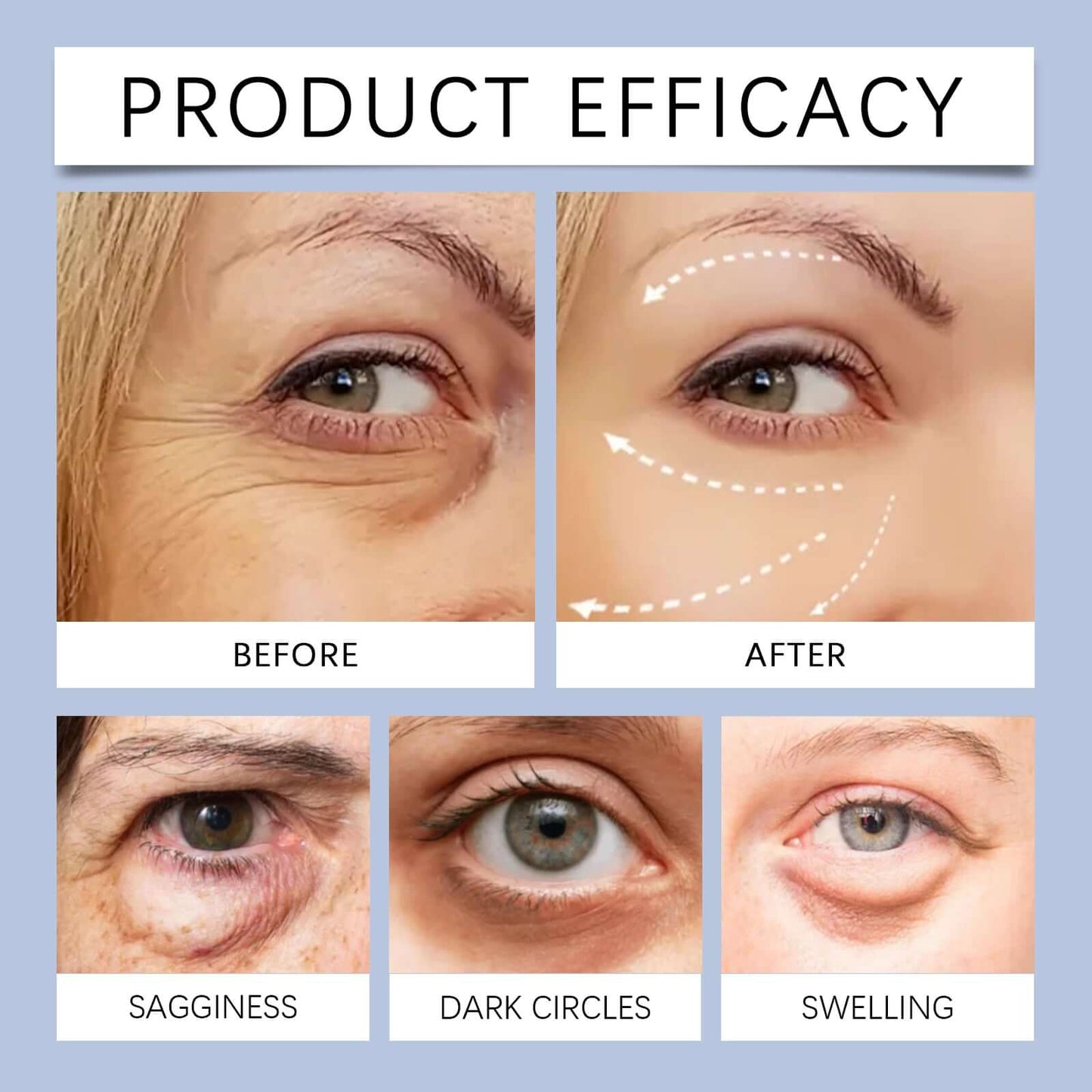 EOHOE Top Selling Electric Eye Cream🥇Deeply Moisturize & Infuse Vitality + Elasticity Around the Eyes